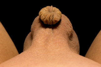 Uncirc_Retainer_Seated_11_19_17