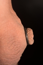 Uncirc_Retainer_12_06_2017-2-1 Uncirc_Retainer_Seated_11_19_17