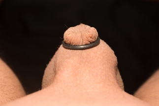 Uncirc_Retainer_12_06_2017-5